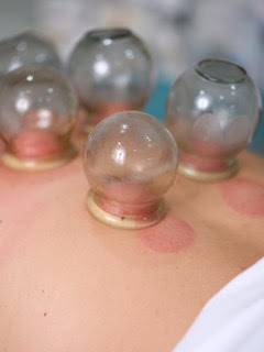 Nizan Pery – Acupuncturist